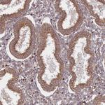 CXorf57 Antibody in Immunohistochemistry (Paraffin) (IHC (P))