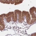 CXorf57 Antibody in Immunohistochemistry (Paraffin) (IHC (P))