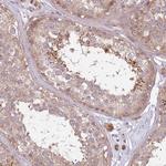 C14orf126 Antibody in Immunohistochemistry (IHC)