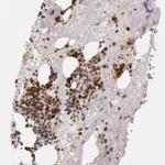 KDM6A Antibody in Immunohistochemistry (Paraffin) (IHC (P))