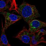 Fetuin A Antibody in Immunocytochemistry (ICC/IF)