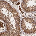 CYB5R3 Antibody in Immunohistochemistry (Paraffin) (IHC (P))