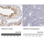 FAM181A Antibody in Immunohistochemistry (IHC)