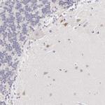 FAM181A Antibody in Immunohistochemistry (IHC)