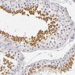 FAM181A Antibody in Immunohistochemistry (IHC)