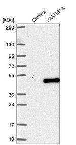 FAM181A Antibody in Western Blot (WB)