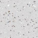 MZF1 Antibody in Immunohistochemistry (IHC)