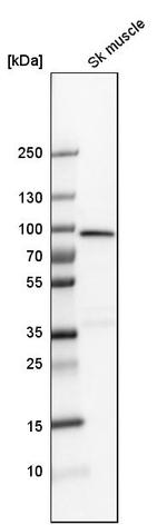 PFKM Antibody in Western Blot (WB)