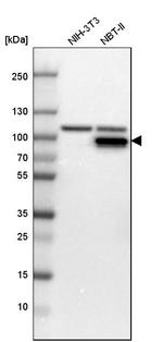 PFKM Antibody in Western Blot (WB)