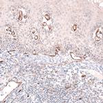 PLVAP Antibody in Immunohistochemistry (IHC)