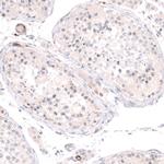 PLVAP Antibody in Immunohistochemistry (IHC)