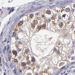 CARS Antibody in Immunohistochemistry (IHC)