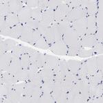 LAX1 Antibody in Immunohistochemistry (Paraffin) (IHC (P))