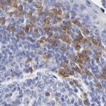 LAX1 Antibody in Immunohistochemistry (IHC)