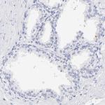 WDR65 Antibody in Immunohistochemistry (IHC)