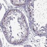 MAGEB1 Antibody in Immunohistochemistry (IHC)