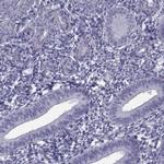 MAGEB1 Antibody in Immunohistochemistry (IHC)