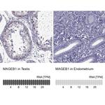 MAGEB1 Antibody