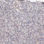 MED12 Antibody in Immunohistochemistry (IHC)