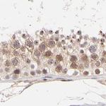 MED12 Antibody in Immunohistochemistry (IHC)