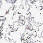 MOSPD2 Antibody in Immunohistochemistry (IHC)