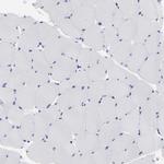 MOSPD2 Antibody in Immunohistochemistry (IHC)