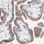 MOSPD2 Antibody in Immunohistochemistry (IHC)