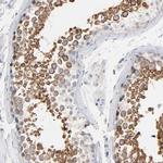 C14orf179 Antibody in Immunohistochemistry (IHC)