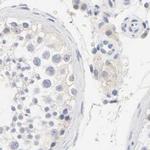 FCGBP Antibody in Immunohistochemistry (IHC)