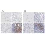 LAX1 Antibody in Immunohistochemistry (IHC)