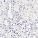 LAX1 Antibody in Immunohistochemistry (IHC)