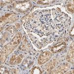 PKN1 Antibody in Immunohistochemistry (IHC)