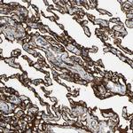 SUSD2 Antibody in Immunohistochemistry (IHC)