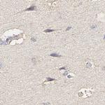 PYGL Antibody in Immunohistochemistry (IHC)