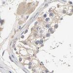 PYGL Antibody in Immunohistochemistry (IHC)