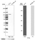 PYGL Antibody in Western Blot (WB)