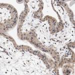 RBM23 Antibody in Immunohistochemistry (IHC)