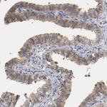 RBM23 Antibody in Immunohistochemistry (IHC)