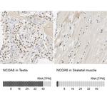 NCOA6 Antibody in Immunohistochemistry (IHC)