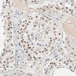 NCOA6 Antibody in Immunohistochemistry (IHC)