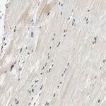 NCOA6 Antibody in Immunohistochemistry (IHC)