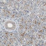 MFI2 Antibody in Immunohistochemistry (IHC)