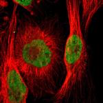 ARID1A Antibody in Immunocytochemistry (ICC/IF)