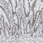 ARID1A Antibody in Immunohistochemistry (IHC)