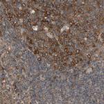 RIOK2 Antibody in Immunohistochemistry (IHC)