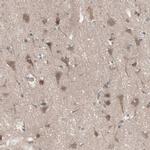 HMBS Antibody in Immunohistochemistry (IHC)