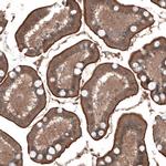 PDZK1 Antibody in Immunohistochemistry (IHC)