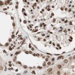 CHAMP1 Antibody in Immunohistochemistry (IHC)