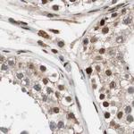 CHAMP1 Antibody in Immunohistochemistry (IHC)