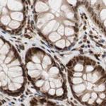 CHAMP1 Antibody in Immunohistochemistry (IHC)